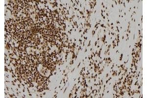 ABIN6278423 at 1/100 staining Human gastric tissue by IHC-P. (ASCL1 antibody  (C-Term))