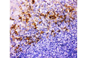 Anti-ITGB1 Picoband antibody,  IHC(P): Human Tonsil Tissue (ITGB1 antibody  (AA 527-728))