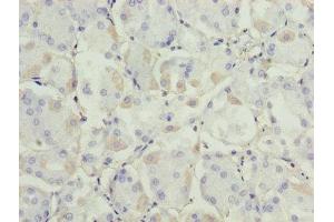 Immunohistochemistry (IHC) image for anti-Alcohol Dehydrogenase 7 (Class IV), mu Or sigma Polypeptide (ADH7) (AA 1-386) antibody (ABIN7143652)