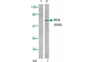 Western blot analysis of extracts from A431 cells untreated or treated with EGF (200 ng/mL 10 min) using RELB (phospho S552) polyclonal antibody .
