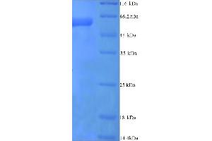 SDS-PAGE (SDS) image for Plasminogen Activator Inhibitor 2 (SERPINB2) (AA 1-416), (full length) protein (His tag) (ABIN4976967)