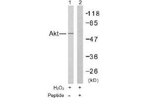 Image no. 2 for anti-V-Akt Murine Thymoma Viral Oncogene Homolog 1 (AKT1) (Thr308) antibody (ABIN197195) (AKT1 antibody  (Thr308))