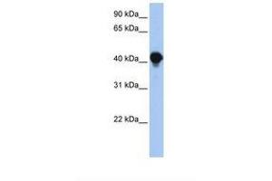 Image no. 1 for anti-Protein tyrosine Phosphatase-Like A Domain Containing 1 (PTPLAD1) (AA 110-159) antibody (ABIN6738323) (PTPLAD1 antibody  (AA 110-159))