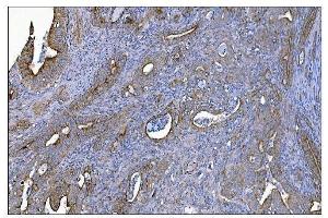 IHC analysis of MERTK using anti-MERTK antibody (ABIN7600623).