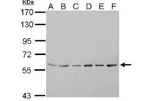 WB Image ASC1 antibody detects TRIP4 protein by Western blot analysis.