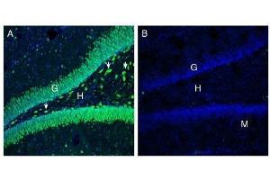 Expression of ATP1B3 in rat hippocampus. (ATP1B3 antibody  (C-Term, Extracellular))