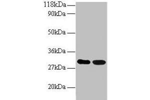 Western blot All lanes: ARHGEF18 antibody at 2 μg/mL Lane 1: EC109 whole cell lysate Lane 2: 293T whole cell lysate Secondary Goat polyclonal to rabbit IgG at 1/15000 dilution Predicted band size: 131, 115 kDa Observed band size: 30 kDa (ARHGEF18 antibody  (AA 159-551))