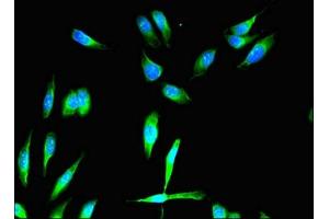 Immunofluorescent analysis of Hela cells using ABIN7152829 at dilution of 1:100 and Alexa Fluor 488-congugated AffiniPure Goat Anti-Rabbit IgG(H+L) (FGFR1 antibody  (AA 22-96))