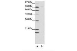 Image no. 1 for anti-Nuclear Receptor Subfamily 2, Group C, Member 1 (NR2C1) (AA 525-574) antibody (ABIN202801) (NR2C1 antibody  (AA 525-574))