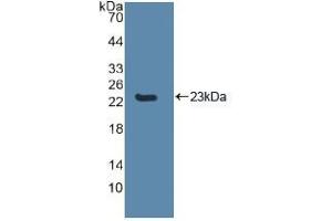 Western blot analysis of recombinant Human CASP8. (Caspase 8 antibody  (AA 217-384))