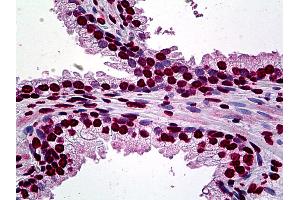 Anti-ATF1 antibody IHC of human prostate. (AFT1 antibody  (AA 1-272))