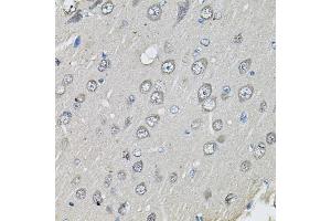 Immunohistochemistry of paraffin-embedded rat brain using CTNNB1 antibody (ABIN4903403) at dilution of 1:100 (40x lens). (CTNNB1 antibody)