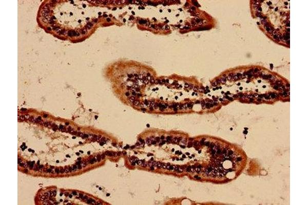 SAA1 antibody  (AA 20-122)