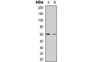 Western blot analysis of CABLES2 expression in Hela (A), Jurkat (B) whole cell lysates. (CABLES2 antibody)