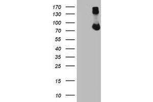 Western Blotting (WB) image for anti-F-Box Protein 21 (FBXO21) antibody (ABIN1498237) (FBXO21 antibody)