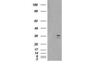 Image no. 2 for anti-Sirtuin 4 (SIRT4) (C-Term) antibody (ABIN374409) (SIRT4 antibody  (C-Term))