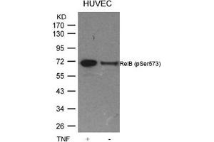 Western blot analysis of extracts from HUVEC cells untreated or treated with TNF using RelB(Phospho-Ser573) Antibody. (RELB antibody  (pSer573))