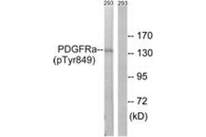 Western blot analysis of extracts from 293 cells, using PDGFRa (Phospho-Tyr849) Antibody.