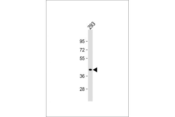 GIPC2 antibody  (C-Term)