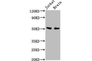 Western Blot Positive WB detected in: Jurkat whole cell lysate, Rat brain tissue All lanes: ONECUT1 antibody at 7.
