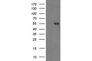Western Blotting (WB) image for anti-Glucosidase, Beta, Acid 3 (Cytosolic) (GBA3) (AA 1-150), (AA 370-469) antibody (ABIN1490582)