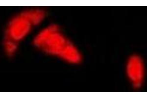 Immunofluorescent analysis of Estrogen Receptor alpha staining in HeLa cells. (Estrogen Receptor alpha antibody)