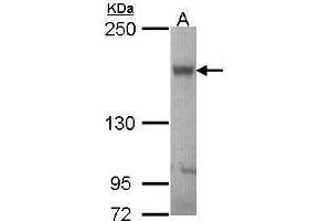 WB Image Sample (30 ug of whole cell lysate) A: JurKat 5% SDS PAGE antibody diluted at 1:1000 (ABCB11 antibody  (Internal Region))
