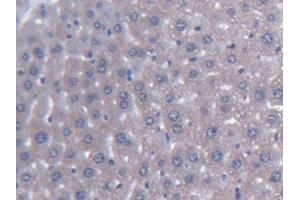 DAB staining on IHC-P; Samples: Mouse Liver Tissue (AGXT2 antibody  (AA 226-513))