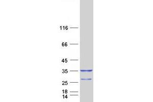 Validation with Western Blot