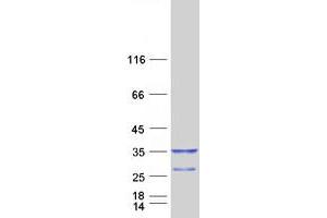 Validation with Western Blot (KCNIP2 Protein (Transcript Variant 3) (Myc-DYKDDDDK Tag))