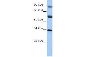 Western Blotting (WB) image for anti-GID Complex Subunit 4, VID24 Homolog (GID4) antibody (ABIN2459711) (GID4 antibody)