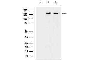 anti-Mannose Receptor, C Type 2 (MRC2) (N-Term) antibody