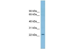 WB Suggested Anti-RNF125 Antibody Titration: 0. (RNF125 antibody  (Middle Region))