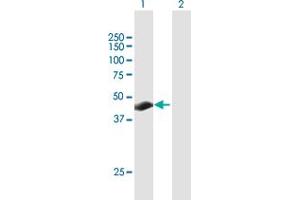 Western Blot analysis of TSPYL3 expression in transfected 293T cell line by TSPYL3 MaxPab polyclonal antibody. (TSPY-Like 3 antibody  (AA 1-355))