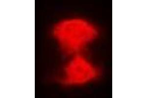 Immunofluorescent analysis of AIPL1 staining in Hela cells. (AIPL1 antibody)