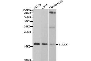 Western blot analysis of extracts of various cell lines, using SUMO2 antibody. (SUMO2 antibody)