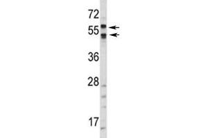Western blot analysis of CA9 antibody and HepG2 lysate. (CA9 antibody  (AA 63-90))