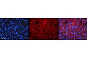 Rabbit Anti-TMED1 Antibody    Formalin Fixed Paraffin Embedded Tissue: Human Adult liver  Observed Staining: Membrane Primary Antibody Concentration: 1:100 Secondary Antibody: Donkey anti-Rabbit-Cy2/3 Secondary Antibody Concentration: 1:200 Magnification: 20X Exposure Time: 0.