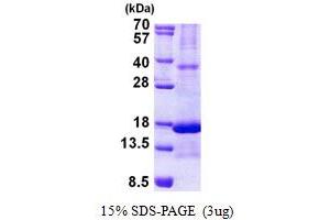 SDS-PAGE (SDS) image for Retinoic Acid Receptor Responder (Tazarotene Induced) 2 (RARRES2) (AA 21-157) protein (His tag) (ABIN5852967)
