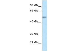 WB Suggested Anti-Pax8 Antibody Titration: 1. (PAX8 antibody  (C-Term))