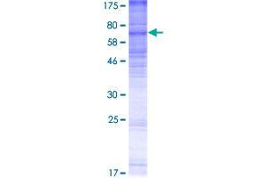 Image no. 1 for Lysophosphatidylcholine Acyltransferase 3 (LPCAT3) (AA 1-487) protein (GST tag) (ABIN1309694) (LPCAT3 Protein (AA 1-487) (GST tag))