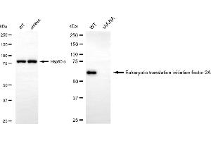 Western blotting analysis using eukaryotic translation initiation factor 2A antibody (ABIN7798513).