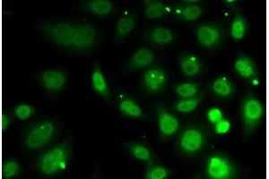 Immunofluorescence analysis of MCF7 cells using DR1 Polyclonal Antibody (DR1 antibody)