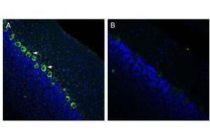 Expression of Renin Receptor in rat cerebellum. (ATP6AP2 antibody  (Extracellular, N-Term))