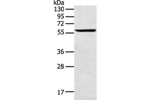 Western Blotting (WB) image for anti-Spermatogenesis Associated 6 (SPATA6) antibody (ABIN2428883) (SPATA6 antibody)