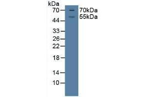 Detection of GR in Porcine Brian Tissue using Polyclonal Antibody to Glucocorticoid Receptor (GR) (Glucocorticoid Receptor antibody  (AA 598-755))