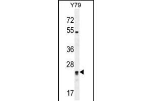 Western blot analysis in Y79 cell line lysates (35ug/lane). (DPCD antibody  (AA 96-136))