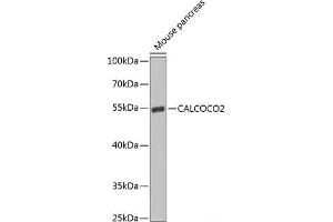 Western blot analysis of extracts of Mouse pancreas using CALCOCO2 Polyclonal Antibody at dilution of 1:1000. (CALCOCO2 antibody)