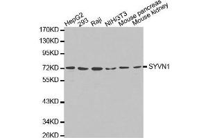 Western blot analysis of extracts of various cell lines, using SYVN1 antibody.