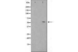 Western blot analysis on HuvEc cell lysate using TINF2 Antibody,The lane on the left is treated with the antigen-specific peptide. (TINF2 antibody  (Internal Region))